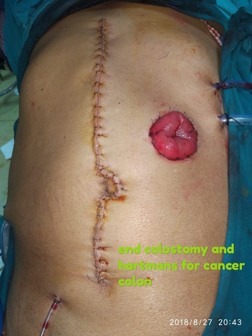 https://shalyagastrocare.com/wp-content/uploads/2022/06/11.jpg