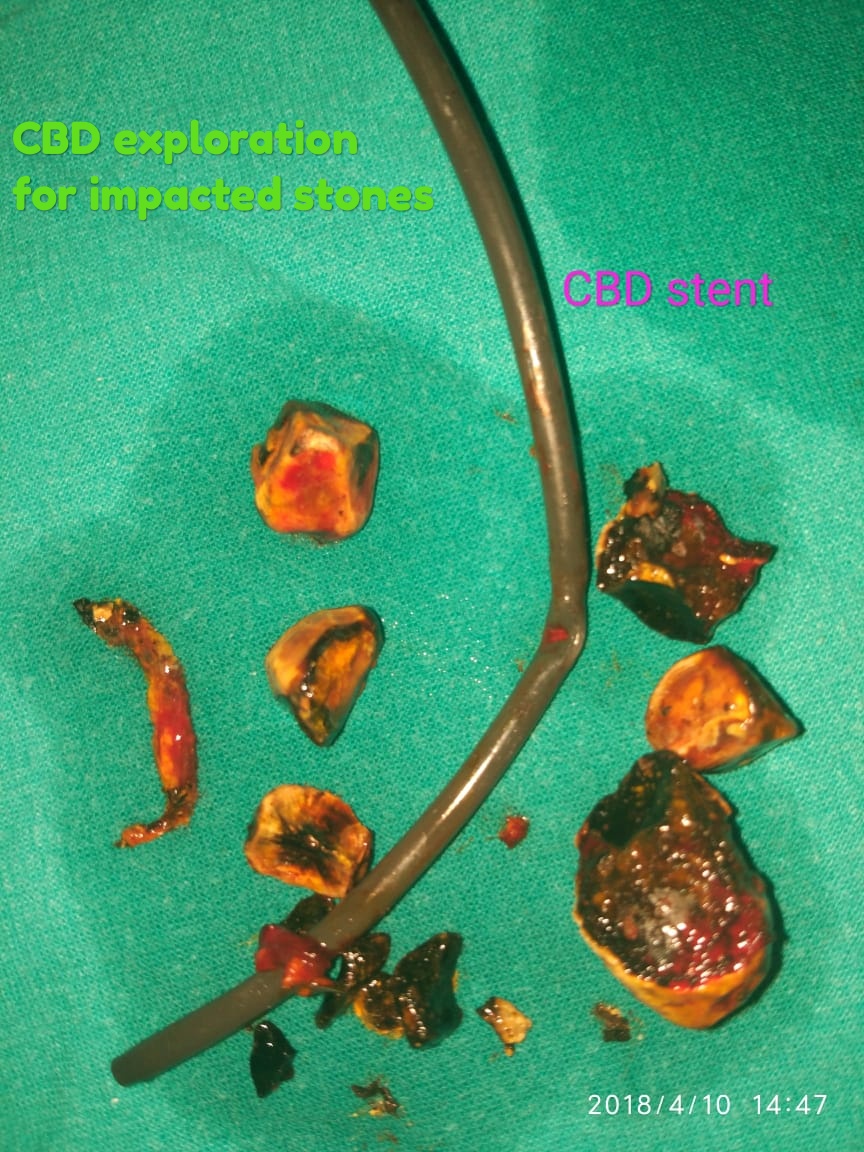 https://shalyagastrocare.com/wp-content/uploads/2022/06/13.jpg